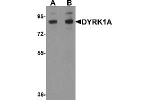 Western blot analysis of DYRK1A in HeLa cell lysate with DYRK1A antibody at (A) 1 and (B) 2 µg/mL. (DYRK1A antibody  (C-Term))