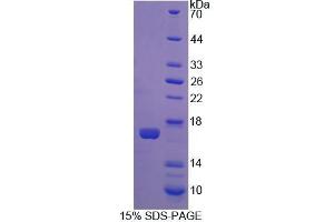 SDS-PAGE analysis of Rat CNR1 Protein.