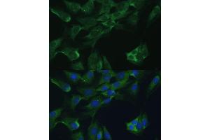 Immunofluorescence analysis of C6 cells using Adenosine Deaminase (Adenosine Deaminase (ADA)) antibody (ABIN3021281, ABIN3021282, ABIN3021283 and ABIN6214343) at dilution of 1:100. (ADA antibody  (AA 1-363))