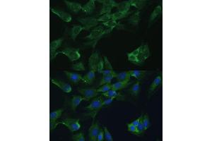 Immunofluorescence analysis of C6 cells using Adenosine Deaminase (Adenosine Deaminase (ADA)) antibody (ABIN3021281, ABIN3021282, ABIN3021283 and ABIN6214343) at dilution of 1:100. (ADA antibody  (AA 1-363))