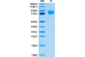 SDS-PAGE (SDS) image for Activated Leukocyte Cell Adhesion Molecule (ALCAM) (AA 28-526) protein (His tag,Biotin) (ABIN7273816)