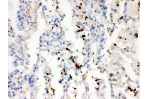 Anti- SFTP A1/2 Picoband antibody, IHC(P) IHC(P): Human Lung Cancer Tissue (SFTPA1/ 2 (AA 206-237), (C-Term) antibody)