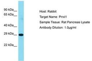 Image no. 1 for anti-Dorsal Root Ganglia Homeobox (DRGX) (AA 101-150) antibody (ABIN6750246)