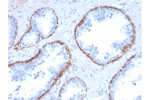 Immunohistochemistry (IHC) image for anti-Keratin 5 (KRT5) (AA 316-590) antibody (ABIN6939864)