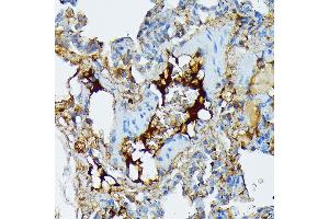 Immunohistochemistry of paraffin-embedded rat lung using Fibrinogen alpha chain (FGA) (FGA) Rabbit mAb (ABIN7267177) at dilution of 1:100 (40x lens). (FGA antibody)