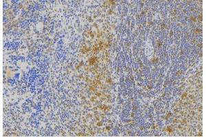 ABIN6273007 at 1/100 staining Human lymph node tissue by IHC-P. (Melanophilin antibody  (C-Term))