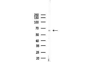 anti-Chromatin Licensing and DNA Replication Factor 1 (CDT1) (C-Term) antibody