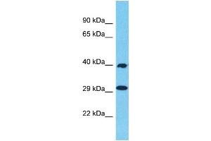 Western Blotting (WB) image for anti-Olfactory Receptor 1N2 (OR1N2) (C-Term) antibody (ABIN2791711) (OR1N2 antibody  (C-Term))