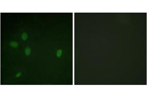 Immunofluorescent staining of NIH/3T3 cells reacted with TP53BP1 (phospho S25) polyclonal antibody  at 1:100-1:500 dilution. (TP53BP1 antibody  (pSer25))