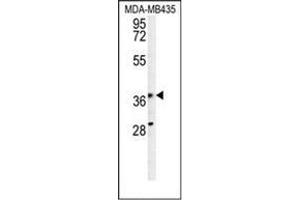 Western blot analysis of PRPSAP1 Antibody (N-term) in MDA-MB435 cell line lysates (35ug/lane).