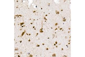 Immunohistochemistry of paraffin-embedded human brain using UB Rabbit mAb (ABIN7271128) at dilution of 1:50 (40x lens). (UBA52 antibody)