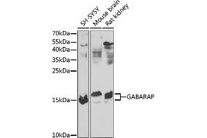 Western blot analysis of extracts of various cell lines, using GABARAP antibody (ABIN6134237, ABIN6140873, ABIN6140876 and ABIN6217999) at 1:1000 dilution.