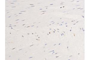 Immunohistochemistry (IHC) image for anti-Epidermal Growth Factor Receptor (EGFR) (pSer1071) antibody (ABIN6256098)