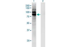 Western Blot analysis of CPXM1 expression in transfected 293T cell line by CPXM1 monoclonal antibody (M02), clone 2G5. (CPXM1 antibody  (AA 610-718))