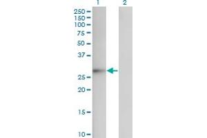 Western Blot analysis of FGF12 expression in transfected 293T cell line by FGF12 monoclonal antibody (M10), clone 1D9.