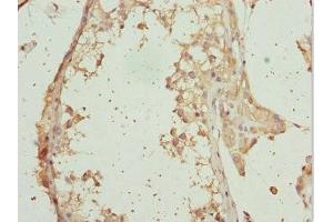 Immunohistochemistry of paraffin-embedded human testis tissue using ABIN7167292 at dilution of 1:100