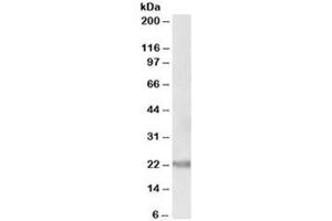 Western blot testing of human prostate lysate with IL-25 antibody at 0. (IL-25 antibody)