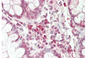 Rabbit Anti-Pou3f1 antibody Catalog Number: ARP33060 Formalin Fixed Paraffin Embedded Tissue: Human Small Intestine Primary antibody Concentration: 1:100 Secondary Antibody: Donkey anti-Rabbit-Cy3 Secondary Antibody Concentration: 1:200 Magnification: 20x Exposure Time: 0. (POU3F1 antibody  (C-Term))