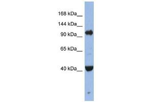 EIF2C4 antibody used at 1 ug/ml to detect target protein. (AGO4 antibody  (Middle Region))