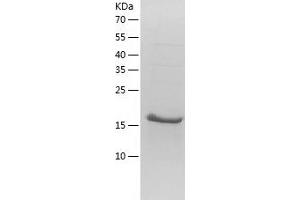 Western Blotting (WB) image for Myosin Regulatory Light Chain 2, Smooth Muscle Isoform (MYL9) (AA 1-172) protein (His tag) (ABIN7124068) (MYL9 Protein (AA 1-172) (His tag))