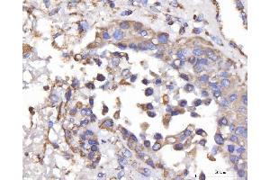 IHC analysis of DLST using anti-DLST antibody (ABIN7599412). (DLST antibody  (AA 1-453))