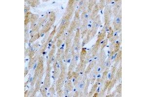 Immunohistochemical analysis of Sorcin staining in rat heart formalin fixed paraffin embedded tissue section.