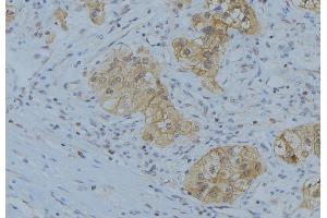 ABIN6266627 at 1/100 staining Human uterus tissue by IHC-P. (Prostate Specific Antigen antibody  (Internal Region))