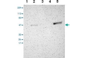 Western blot analysis of Lane 1: RT-4, Lane 2: U-251 MG, Lane 3: Human Plasma, Lane 4: Liver, Lane 5: Tonsil with TRAF1 polyclonal antibody . (TRAF1 antibody)