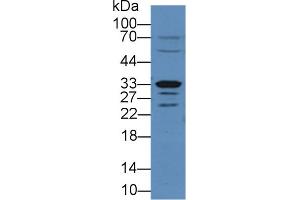 Western Blotting (WB) image for anti-Arginase, Type II (ARG2) (AA 23-354) antibody (ABIN7437683)