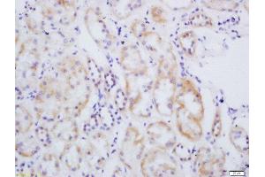 Formalin-fixed and paraffin embedded human kidney labeled with Rabbit Anti-eNOS (Ser1177) Polyclonal Antibody, Unconjugated 1:200 followed by conjugation to the secondary antibody and DAB staining (ENOS antibody  (pSer1177))