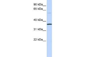 WB Suggested Anti-C16orf46 Antibody Titration: 0. (C16ORF46 antibody  (N-Term))