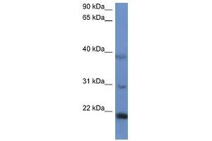 Western Blot showing IMMP2L antibody used at a concentration of 1-2 ug/ml to detect its target protein. (IMMP2L antibody  (N-Term))
