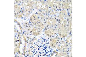 Immunohistochemistry of paraffin-embedded mouse kidney using BSND antibody at dilution of 1:100 (x40 lens).