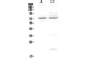 Western blot analysis of CHM using anti-CHM antibody . (CHM antibody  (AA 193-380))