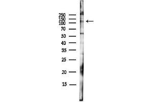 Western blot analysis of lysates from EC304 cells(LPS,4h treatment), using EPH Antibody at 1/1000 dilution.