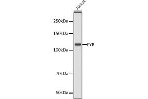 Western blot analysis of extracts of Jurkat cells, using FYB antibody (ABIN7267283) at 1:1000 dilution. (FYB antibody  (AA 678-829))