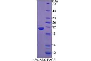 Image no. 1 for Urocortin 3 (UCN3) (AA 24-164) protein (His tag) (ABIN6236959) (UCN3 Protein (AA 24-164) (His tag))