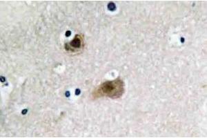 Immunohistochemistry (IHC) analyzes of JAB1 antibody in paraffin-embedded human brain tissue. (COPS5 antibody)