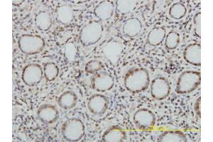 Immunoperoxidase of monoclonal antibody to TOP1 on formalin-fixed paraffin-embedded human stomach. (Topoisomerase I antibody  (AA 692-765))