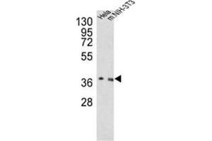 Western blot analysis of OGG1 Antibody (C-term) in Hela, NIH-3T3 cell line lysates (35ug/lane).