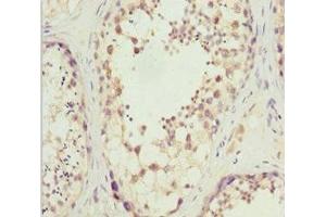SLC9A6 antibody  (AA 510-669)