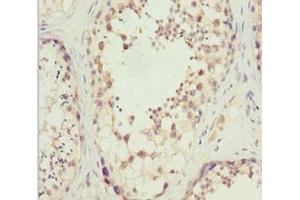 Immunohistochemistry of paraffin-embedded human testis tissue using ABIN7170027 at dilution of 1:100