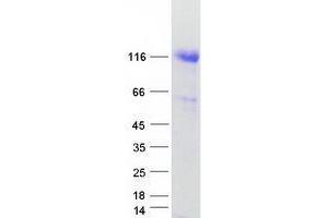 Validation with Western Blot (UBA1 Protein (Transcript Variant 1) (Myc-DYKDDDDK Tag))