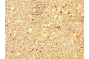 Immunohistochemistry of paraffin-embedded human brain tissue using ABIN7169120 at dilution of 1:100 (NIM1 antibody  (AA 1-436))