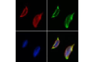 ABIN6261625 and ABIN6273045 staining Hela by IF/ICC. (EXOC1 antibody  (N-Term))