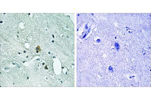 P-peptide - +Immunohistochemistry analysis of paraffin-embedded human brain tissue using IP3R1 (Phospho-Ser1764) antibody. (ITPR1 antibody  (pSer1764))