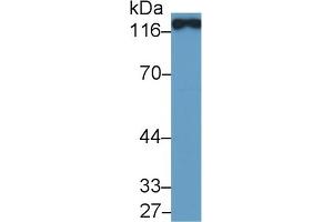 Detection of ACE2 in Porcine Kidney lysate using Polyclonal Antibody to Angiotensin I Converting Enzyme 2 (ACE2) (ACE2 antibody  (AA 392-739))