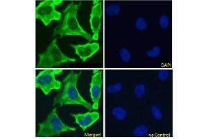 Immunofluoresence staining of fixed HeLa cells with anti-EGFR antibody 528. (Recombinant EGFR antibody)