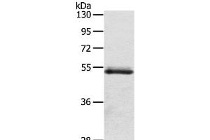 Western Blot analysis of Human normal colon sigmoideum tissue using OLFM4 Polyclonal Antibody at dilution of 1:200 (Olfactomedin 4 antibody)