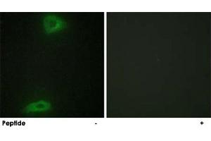 Immunofluorescence analysis of HepG2 cells, using ERGIC3 polyclonal antibody . (ERGIC3 antibody)